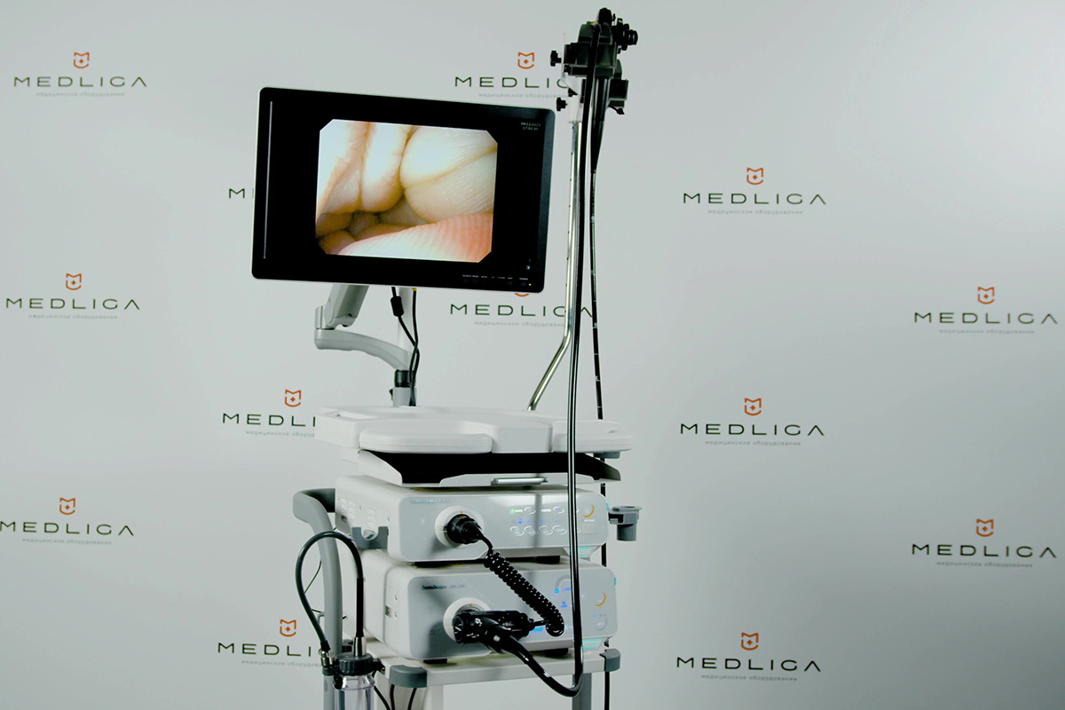 Видеообзор эндоскопической системы Sonoscape HD-350