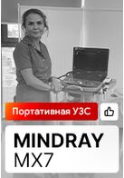 Отзыв на поставку УЗИ аппарата Mindray MX7 (г. Уфа)