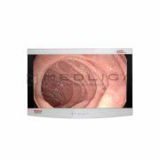 NDS Radiance Ultra 27"