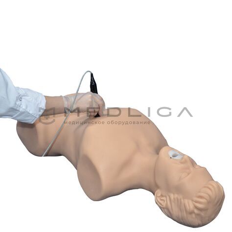 MedVision SonoVision