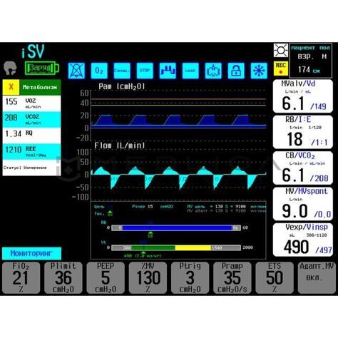 Triton ZISLINE МV300 К1.22, 4