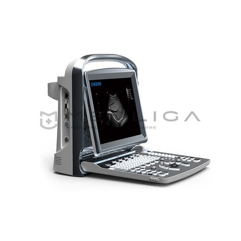 Chison SonoTouch 10, 2