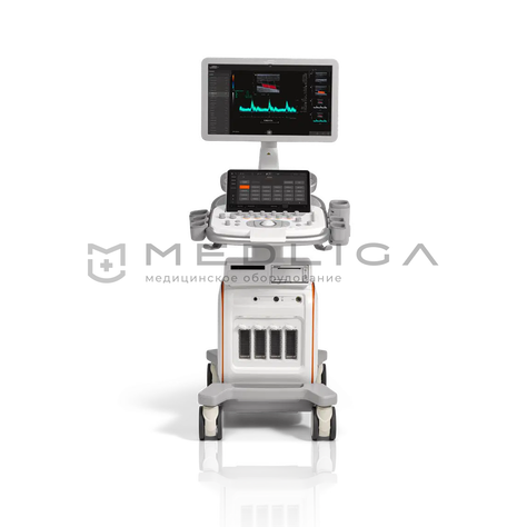 Siemens ACUSON Redwood, 2